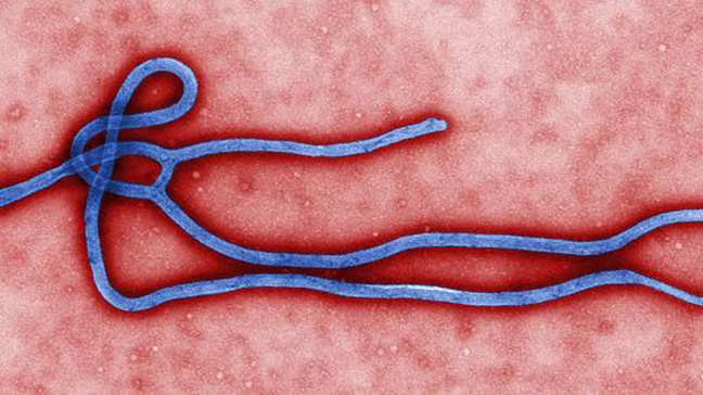 Top 10 Deadly And Strong Viruses Of World